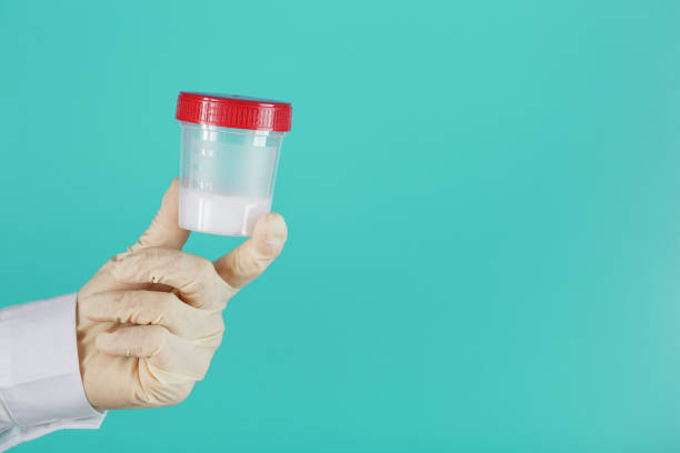 istock Semen in a jar for analysis in the doctor's hand on a blue background. 1279281487