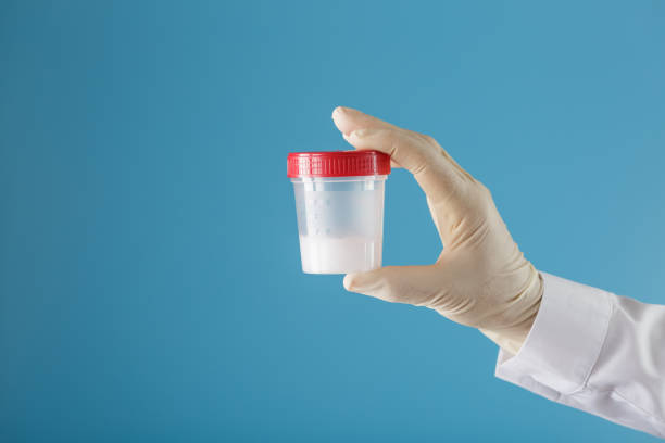istock Semen in a jar for analysis in the doctor's hand on a blue background. 1279281495