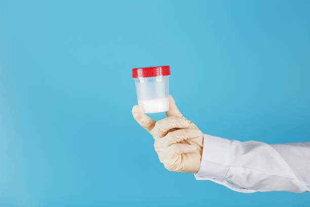 istock Semen in a jar for analysis in the doctor's hand on a blue background. 1279281755