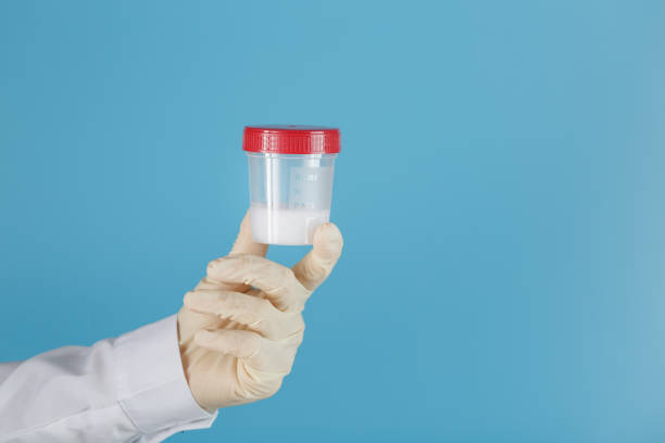 istock Semen in a jar for analysis in the doctor's hand on a blue background. 1279281899