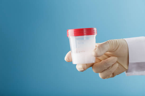istock Semen in a jar for analysis in the doctor's hand on a blue background. 1279281961