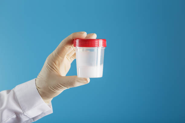 istock A doctor's gloved hand holding a bottle of a container with a sperm sample for medical analysis. 1279281971