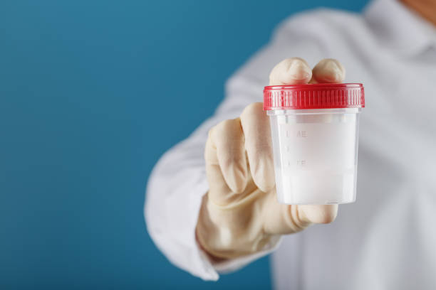 istock A doctor's gloved hand holding a bottle of a container with a sperm sample for medical analysis. 1279282062