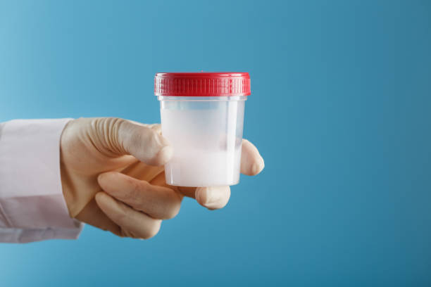 istock Semen in a jar for analysis in the doctor's hand on a blue background. 1279282082