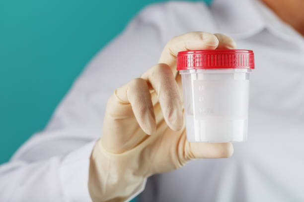 istock A doctor's gloved hand holding a bottle of a container with a sperm sample for medical analysis. 1279282639