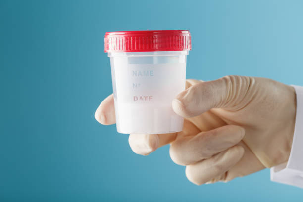 istock A doctor's gloved hand holding a bottle of a container with a sperm sample for medical analysis. 1279282656