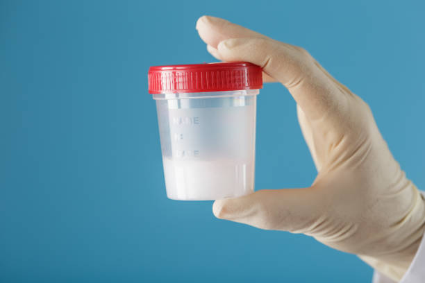 istock Semen in a jar for analysis in the doctor's hand on a blue background. 1279282689
