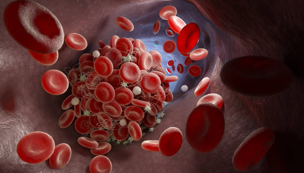formation d’un caillot sanguin - thrombose photos et images de collection