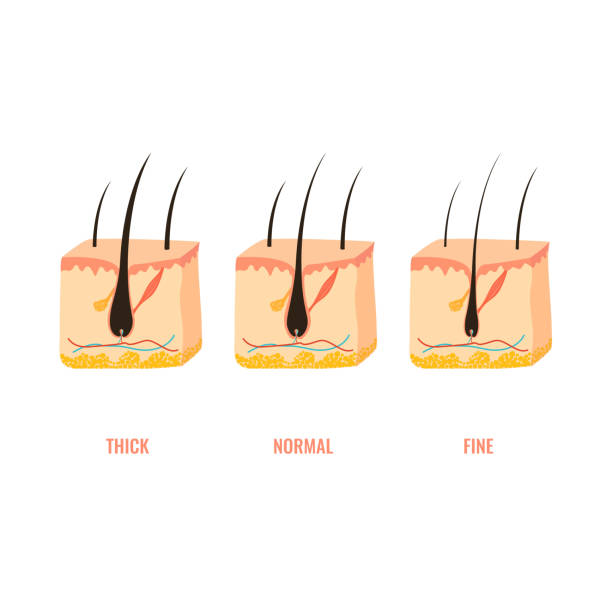 ilustrações de stock, clip art, desenhos animados e ícones de hair width structure in skin cross-section diagram - thick