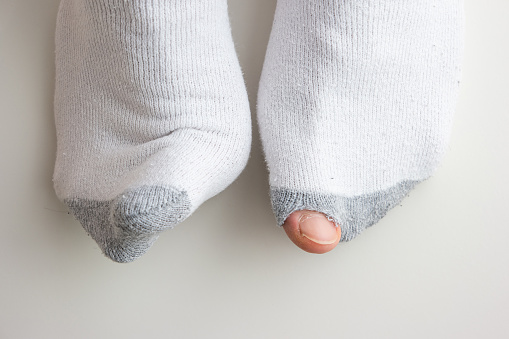 Caucasian Male Toe Sticking Out Of Worn Out Short White Socks With Hole ...