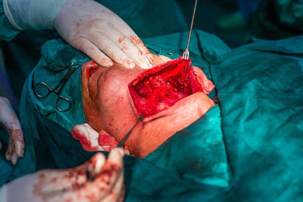 хирургия сонной артерии шеи - surgery human artery human hand carotid artery стоковые фото и изображения