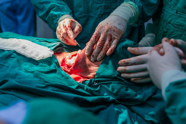 cirugía del cuello de la arteria carótida - surgery human artery human hand carotid artery fotografías e imágenes de stock