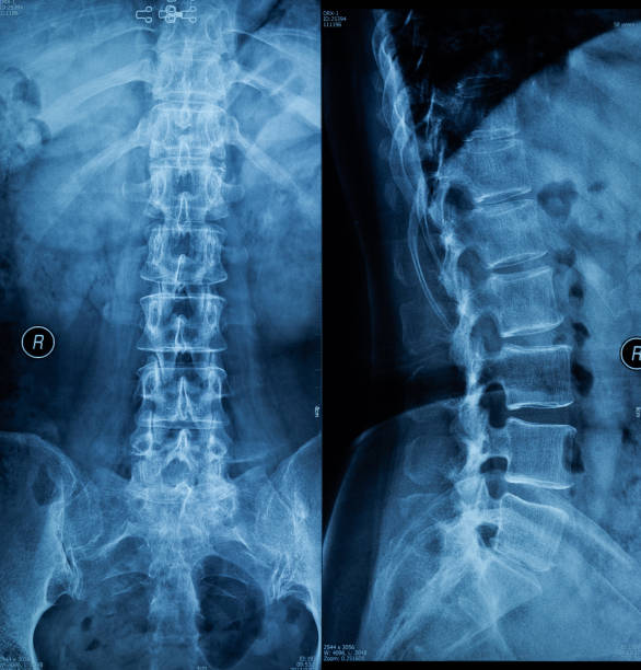 Spine X-ray Film Spine X-ray Film coccyx photos stock pictures, royalty-free photos & images