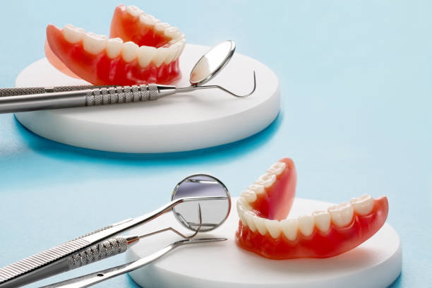 istock Teeth model showing an implant crown bridge model. 1279731639