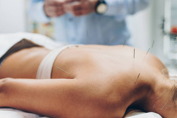 istock Acupuncture and massage treatment 1279793425