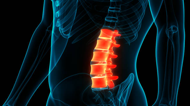 kręgosłup kręgosłupa kręgosłupa kręgów lędźwiowych ludzkiego szkieletu anatomii - paralysis human spine x ray image human bone zdjęcia i obrazy z banku zdjęć