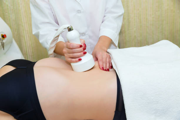 istock Anti-cellulite massage with cavitation on the abdomen 1279920496
