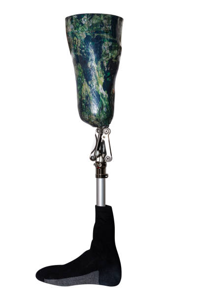 istock A prosthetic leg with a green leg socket and a black sock, isolated on a white background with a clipping path, the foot turned to the left. 1280140587