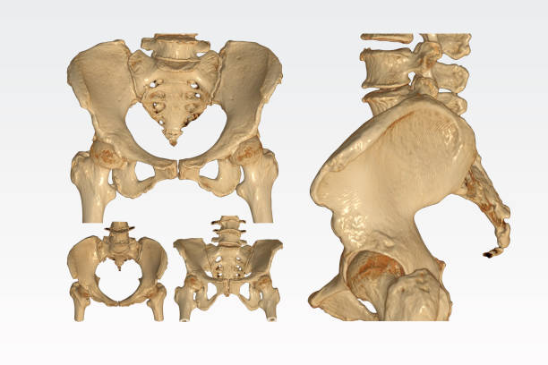 istock Collection of CT Scan pelvic bone with both hip joint 3D rendering image  isolated on white background. Clipping path. 1280294692