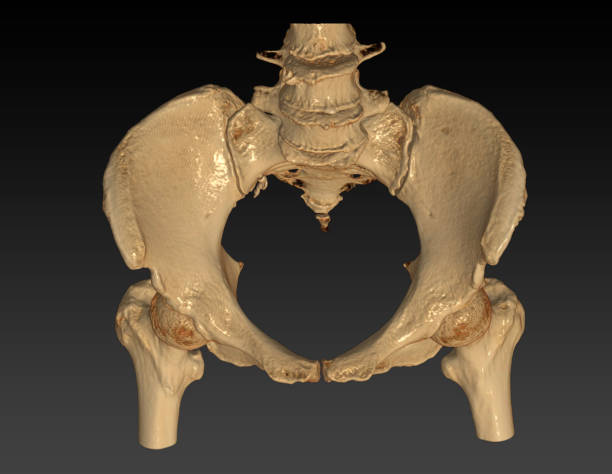 両方の股関節3dレン�ダリング画像入口ビューと骨盤骨のctスキャン. - cat scan pelvis hip human spine ストックフォトと画像