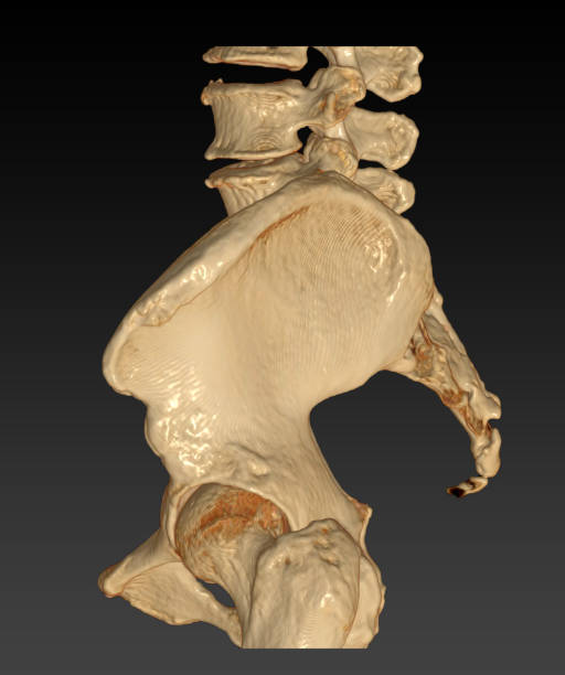tomografia computadorizada do osso pélvico com a imagem de renderização 3d da articulação do quadril posteriorla - cat scan pelvis hip human spine - fotografias e filmes do acervo