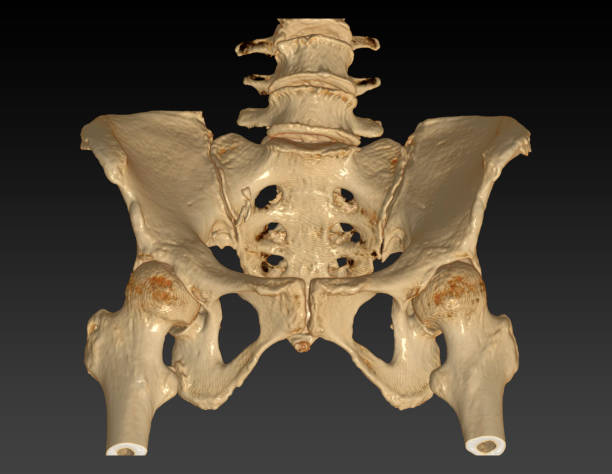 両方の股関節3dレンダリング画像アウトレットビューと骨盤骨のctスキャン. - cat scan pelvis hip human spine ストックフォトと画像