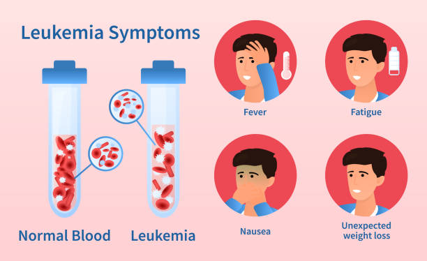 ilustrações de stock, clip art, desenhos animados e ícones de leukemia dangerous disease concept - red blood cell