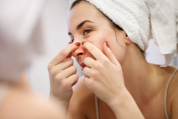Reflection of woman with towel on head squeezing blackhead on her nose side Reflection of woman in bathroom mirror wearing towel on hair after shower, squeezing blackead on her nose side with index fingernails pimple stock pictures, royalty-free photos & images