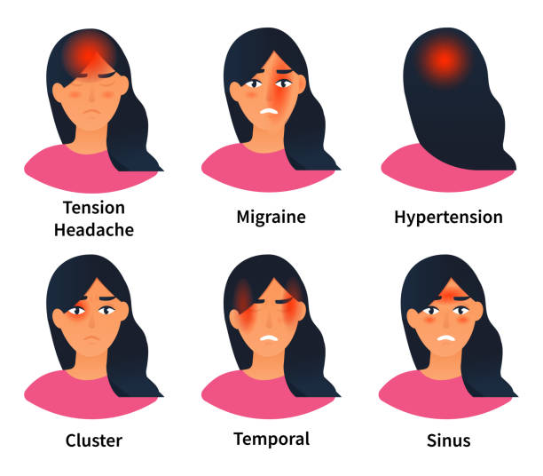 Illustrations showing types of headaches A set of vector illustrations showing different types of headaches. Medical banner or poster. Stress and sinus ache, migraine and tension. Pain in different areas of head. Flat vector concept types of migrain stock illustrations