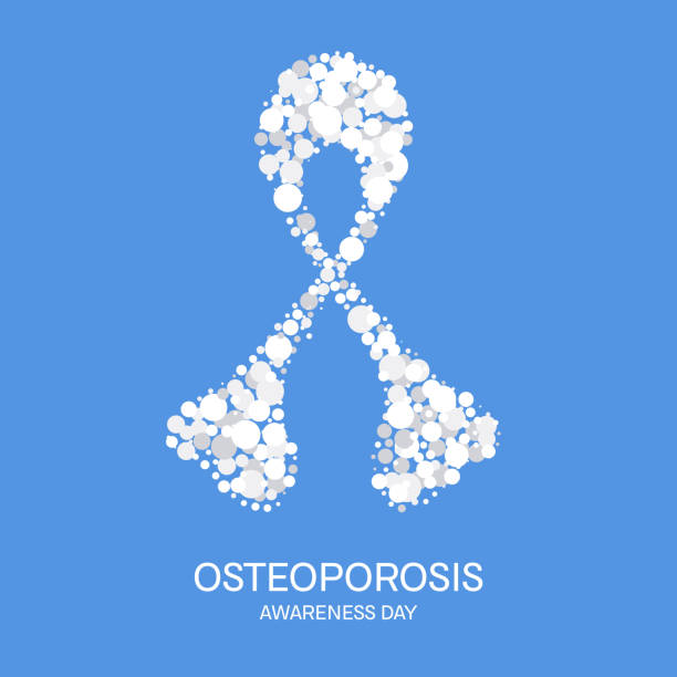 Osteoporosis bone disease awareness ribbon medical concept White ribbon made of dots on blue background. Osteoporosis awareness poster for bone density loss prevention. Skeletal system disease. Medical concept. Vector illustration. osteoporosis awareness stock illustrations
