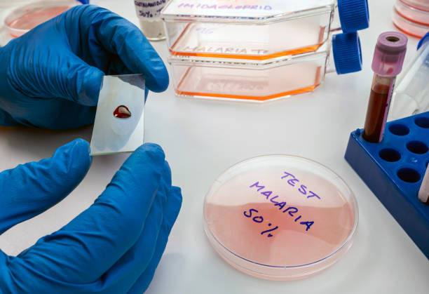 científico examina la muestra de sangre de la persona enferma con malaria en laboratorio, imagen conceptual - acetylcholine fotografías e imágenes de stock