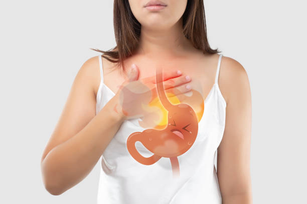 The Photo Of Cartoon Stomach On Woman's Body Against White Background, Acid Reflux Disease Symptoms Or Heartburn, Concept With Healthcare And Medicine The Photo Of Cartoon Stomach On Woman's Body Against White Background, Acid Reflux Disease Symptoms Or Heartburn, Concept With Healthcare And Medicine heartburn photos stock pictures, royalty-free photos & images