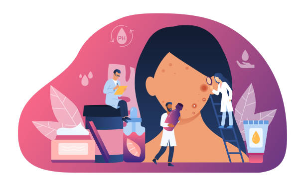 Abstract skin care concept with tiny people Abstract dermatology or skin care concept with tiny people doctors treating girls sick and inflamed face skin. Facial problems. Cosmetology Procedures. Flat cartoon vector illustration dermatologist stock illustrations