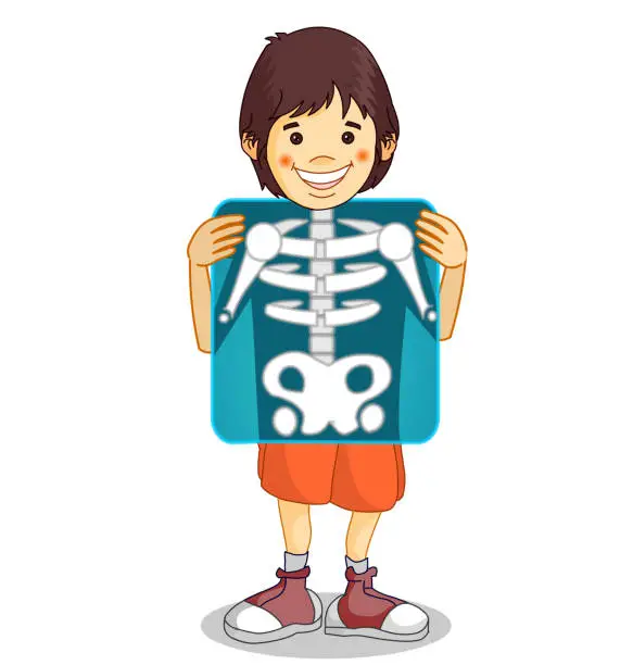 Vector illustration of X-ray, Roentgen. Röntgen film. Xray shows the breast, ribs, spine, and pelvis bones. Cartoon body x ray of child boy character. Medical educational drawing.  Biology, radiology illustration Vector