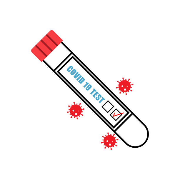 Positive test tube with cotton swab for nasopharyngeal specimens.Virus representation. Tube for testing in laboratory on coronavirus SARS CoV-2. Nasopharyngeal test for determination Covid-19 NCP. Vector illustration Positive test tube for testing in laboratory on coronavirus SARS CoV-2. Nasopharyngeal test for determination Covid-19 NCP. Vector illustration in three colors bloody nose stock illustrations