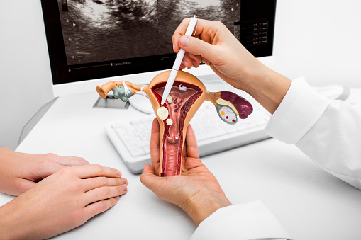 Modelo anatómico de primer plano del útero con patologías. Ginecólogo mostrando los pólipos del útero. Enfermedades y tratamientos ginecológicos photo