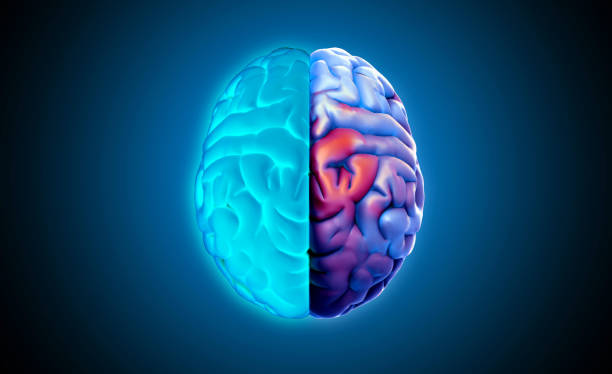 istock 3D rendering brain top view blue on left and colorful red on right 1280938992