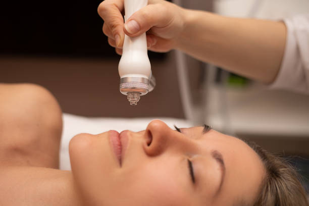 Close-up Of Woman Getting Facial Hydro Microdermabrasion Peeling Treatment At Cosmetic Beauty Spa Clinic. Hydra Vacuum Cleaner. Exfoliation, Rejuvenation And Hydratation. Cosmetology. Face Skin Care. primer plano de la mujer que recibe tratamiento facial de peeling de microdermabrasión en la clínica de spa de belleza cosmética. cuidado de la piel de la cara. limpiador de vacío hydra. exfoliación, rejuvenecimiento e hidratación. cosmetología.