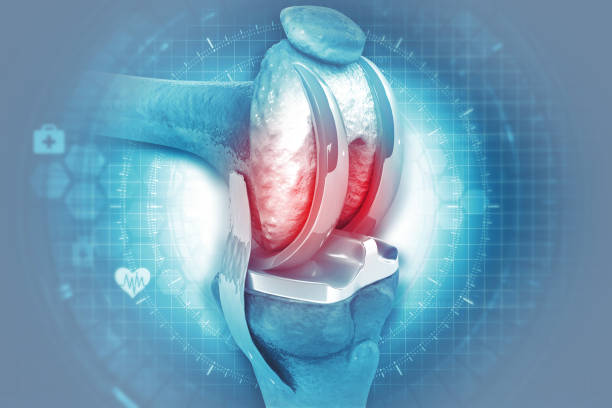 istock Human knee surgery on scientific background 1281249032