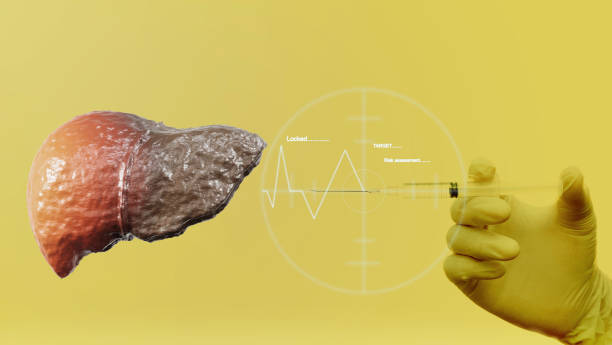 Health care with the Hepatitis vaccine concept. Cirrhosis with a hand holding a syringe vaccine on yellow background. 3d illustration. Health care with the Hepatitis vaccine concept. Cirrhosis with a hand holding a syringe vaccine on yellow background. 3d illustration. deter stock pictures, royalty-free photos & images