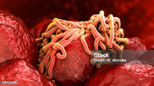 Parasitic Worms In Intestine Stock Photo - Download Image Now - Parasitic, Intestine, Dog