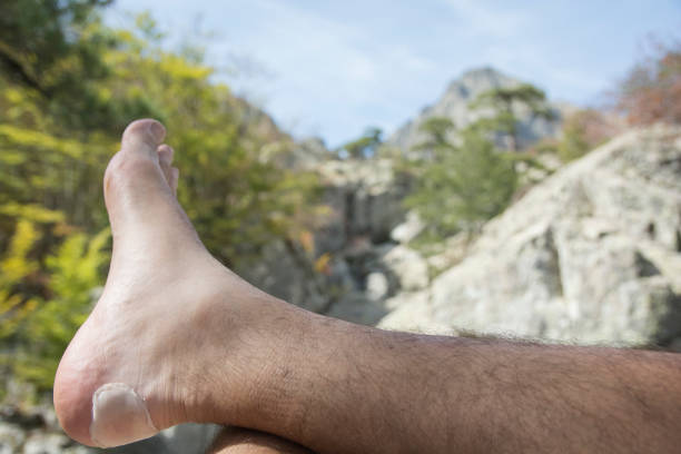Man's foot with a band aid, relaxing during a hike stock photo