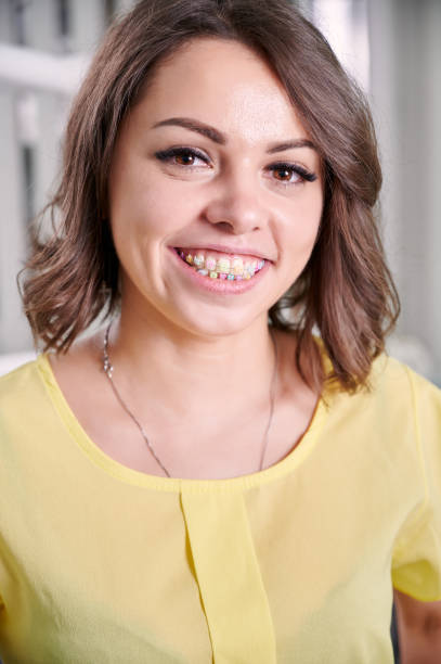 istock Beautiful young woman demonstrating teeth with braces. 1281462902