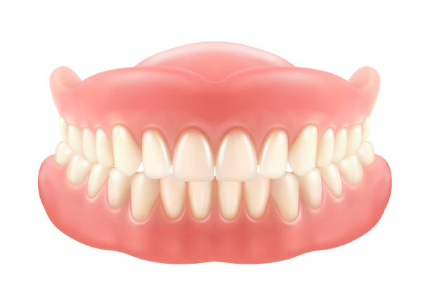 ilustrações, clipart, desenhos animados e ícones de mandíbula dentária ou dentadura, dentes falsos com incisivos - dental implant dental hygiene dentures prosthetic equipment