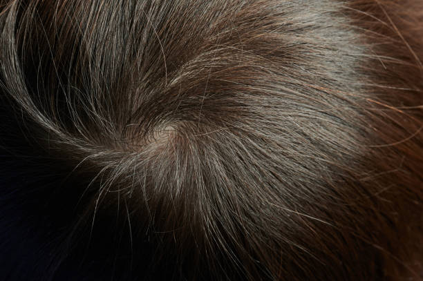 istock Dark hair around occiput 1281674103