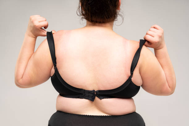 뚱뚱한 뒤를 가진 과체중 여자, 회색 배경에 비만 여성 몸 - bra 뉴스 사진 이미지