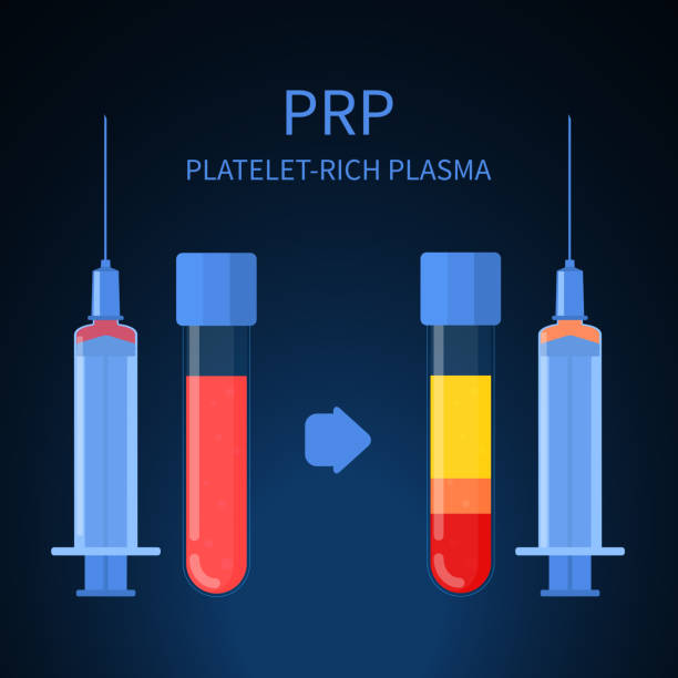 thrombozytenreiche plasmatherapie verfahren infografik poster - face lift illustrations stock-grafiken, -clipart, -cartoons und -symbole