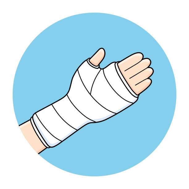Broken Arm Bone Fracture Orthopedic Plaster Cast Icon Stock Illustration -  Download Image Now - iStock