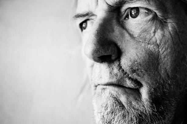 Face of senior man with scar and bruises stock photo