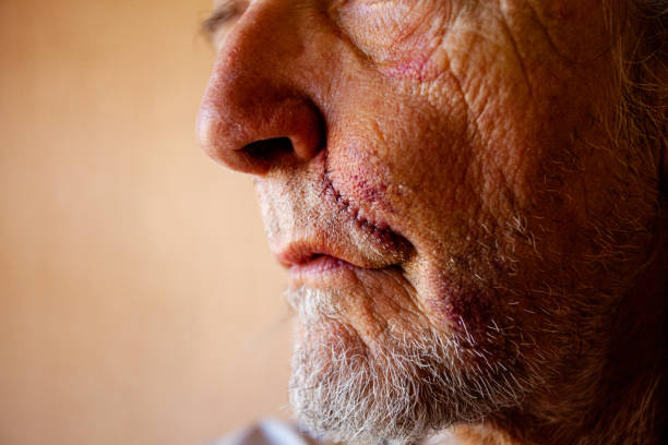 Face of senior man with scar and bruises stock photo